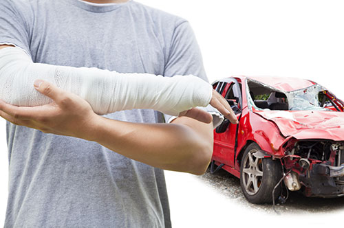 交通事故で骨折した場合の慰謝料相場と弁護士に依頼すべき5つの理由とは